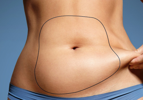 Can you get liposuction without anyone knowing?