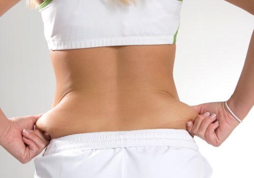 The Truth About Liposuction: Risks and Recovery