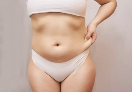 The Truth About Liposuction: What You Need to Know