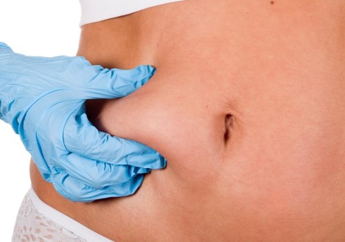 What age is liposuction safe?